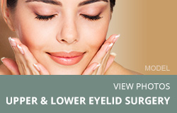 View Photos. Upper & Lower eyelid surgery