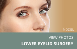 View Lower Eyelid Surgery Photos