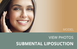 View Submental Liposuction Photos