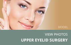 View Upper eyelid surgery photos