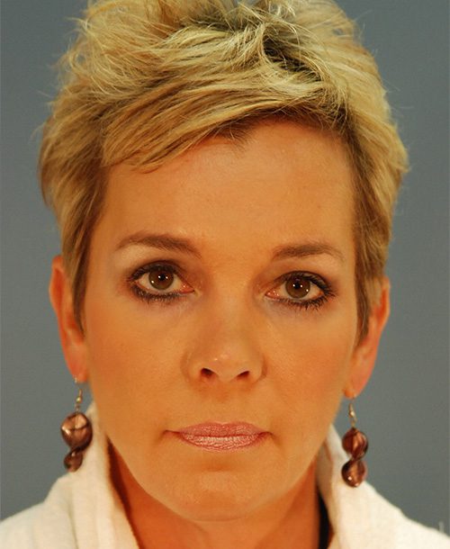 Case--1450 | After AFI To Face 