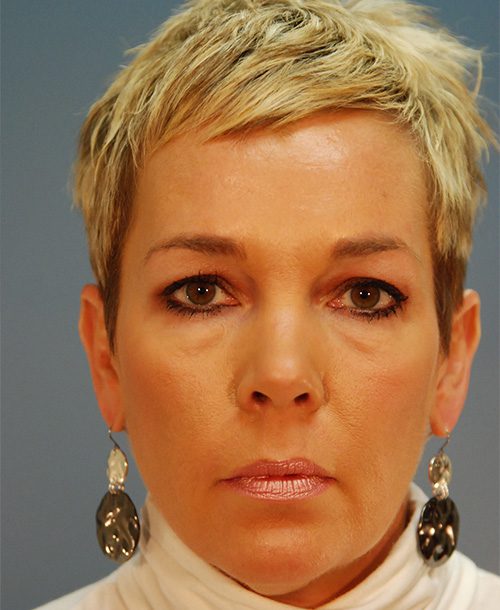 Case--1450 | Before AFI To Face 