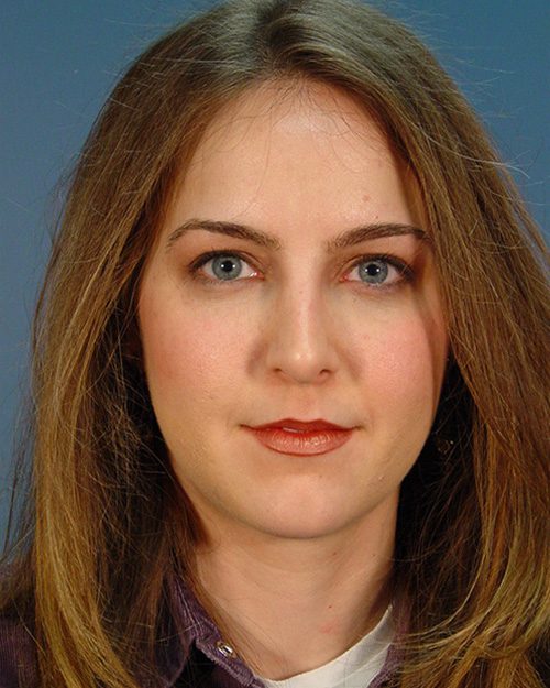 Case--4049 | After Rhinoplasty 